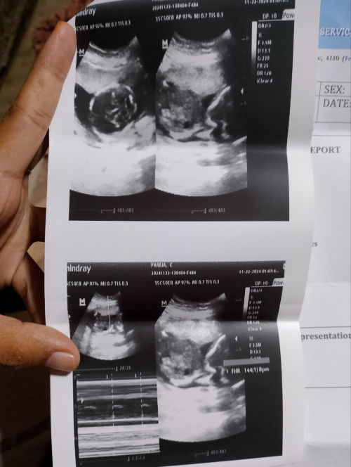 Ask lang po, okay po ba si baby base sa ultrasound?