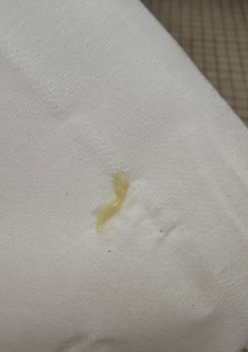 Mga mi normal lang ba sa 9 weeks na may yellowish discharge?