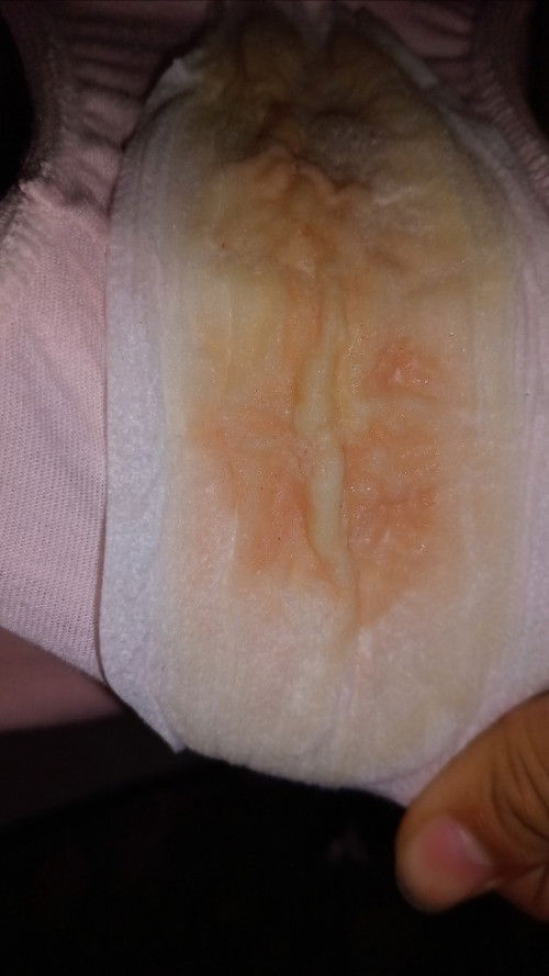 Discharge with blood