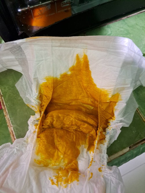 Pup bayi asi 2bulan 8hari