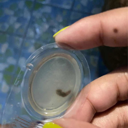 ตั้งครรภ์ 6w เคยแท้งเดือน กย