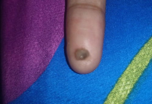 Bund mohon maaf pertanyaan dan fotonya kurang sopan, atau menjijikan🙏 tapi mohon pencerahannya yaa