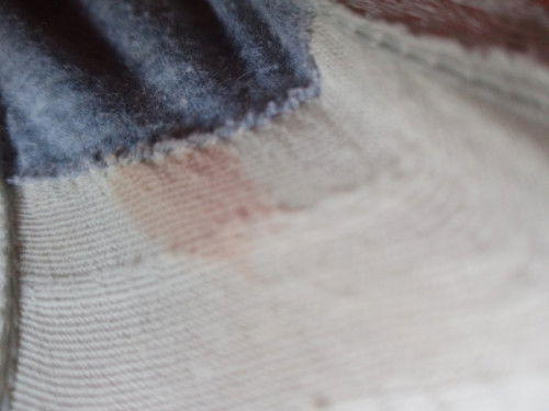 Bun mau nanyak ini flek atau apa ya, saya kurang paham karna ini hamil anak pertama