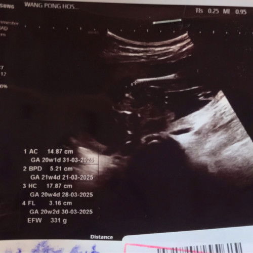 ในรูปอันตราซาวต์คือส่วนไหนของน้องคะแม่ๆ