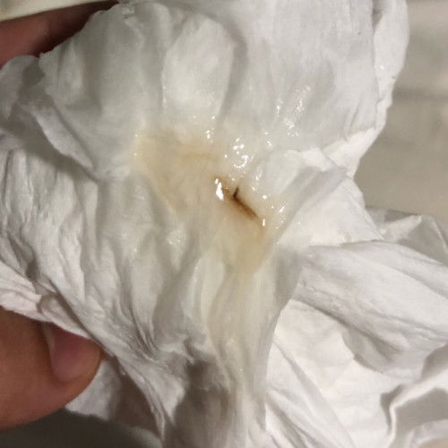 Lendir coklat sikit.