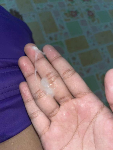 36+5 weeks แบบนี้มูกหรือตกขาวค่ะ