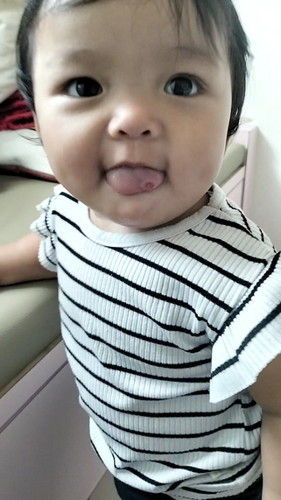 Assalamualaikum.. ada sesiapa tahu apa jadi dgn lidah anak saya ?