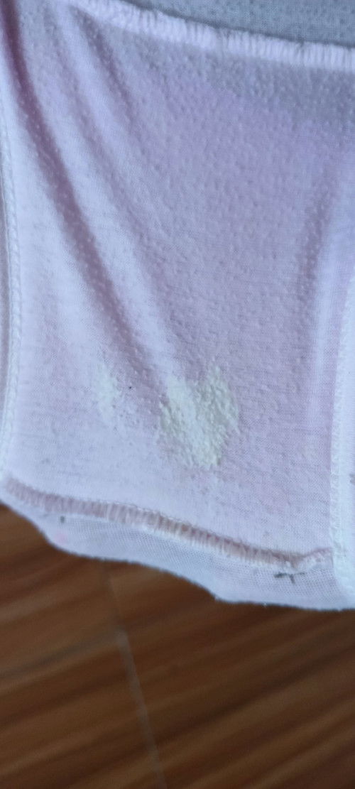 Normal po ba yung ganitong discharge?