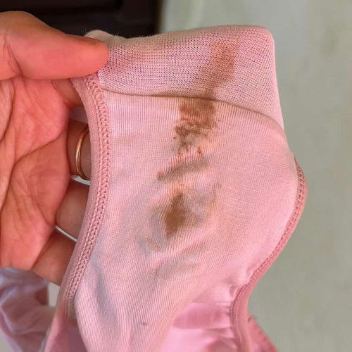 Flek kehamilan 7 week