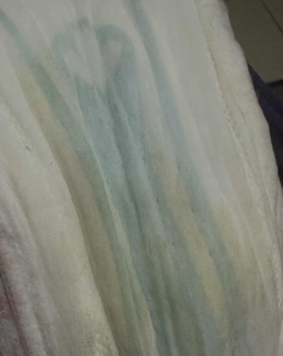 Cecair or lendir kekuningan