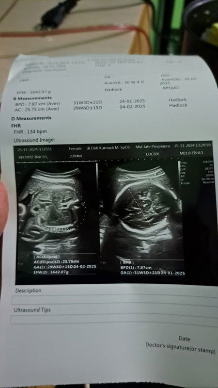 Ijin bertanya yah mom!