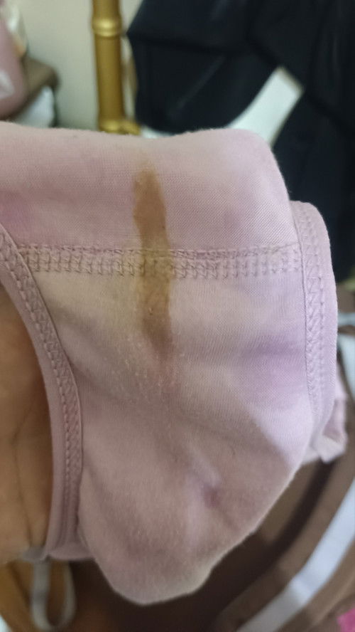 Tiba tiba flek saat hamil 17 minggu