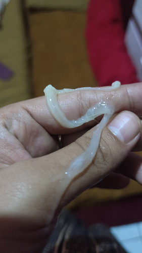 keluar lendir di 35minggu itu kenapa yaaa sama sering mules trus perut ny keras ..