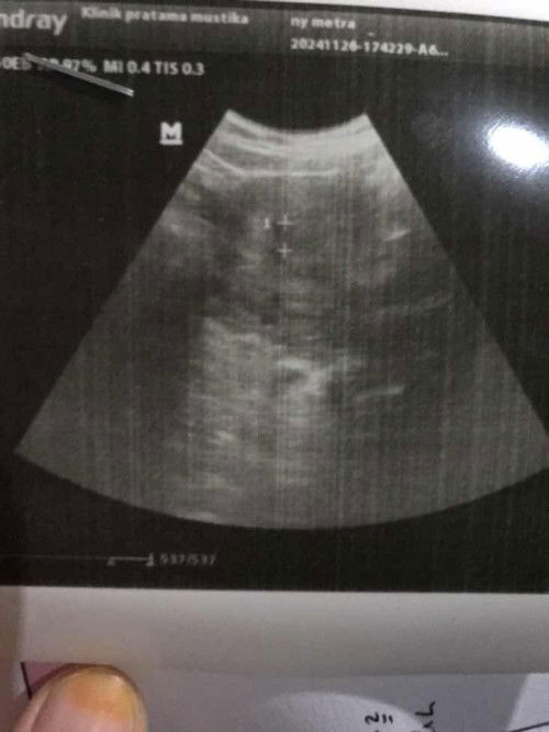 bun ada yang sama gak?