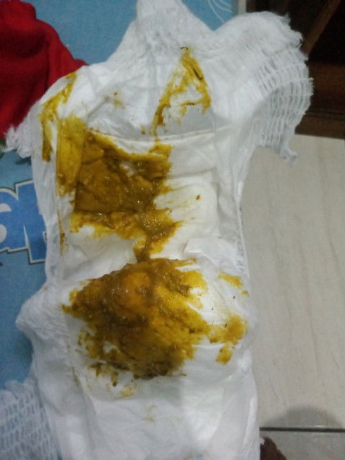 Pup bayi usia 4 bulan, (asi full)
Agak brwarna hijau, brampas, berlendir dan seperti ada serat hitam