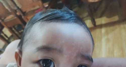Puti puti