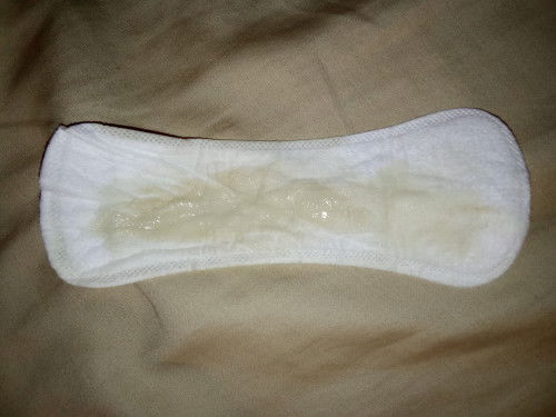 Please pakisagot  po sorry to post, I need answer