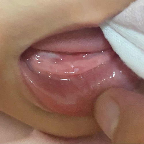 สอบถามแม่แม่หน่อยคะอันนี้ใช่ฟันมั้ยคะ