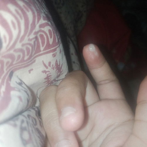 Mau tanya Bun usia kehamilan 33 week lewat 4 hari keputihan kok tambah banyak y bun.