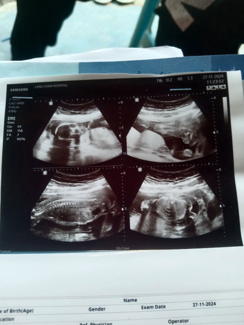 ทายเพศเล่นๆกันคะ ผู้หญิงหรือผู้ชายน่าา🫣