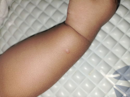 Anakku umur 3 bulan kurang