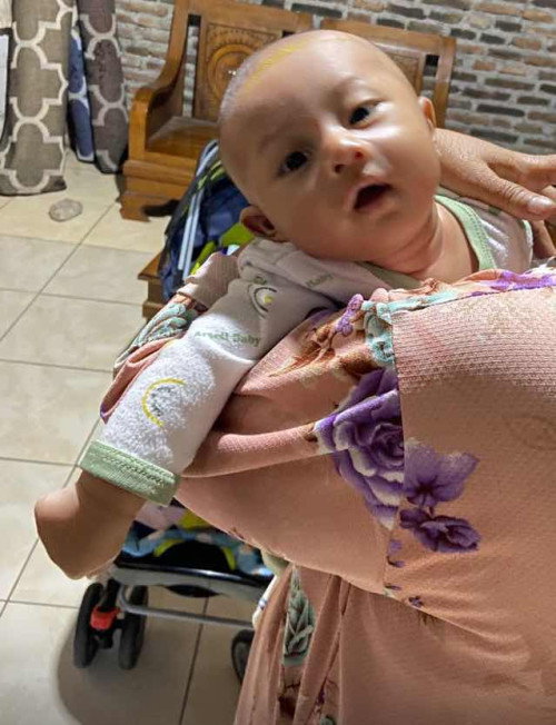 Normal apa tengkleng ini ya bun?