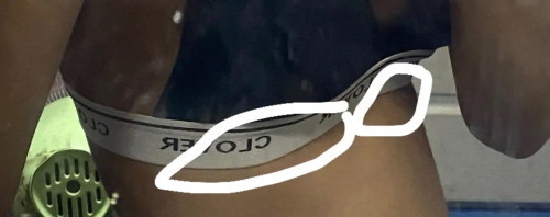 31วีค4วันเจ็บใต้ราวนมกับแสบร้อนกลางอกปกติมั้ยคะ