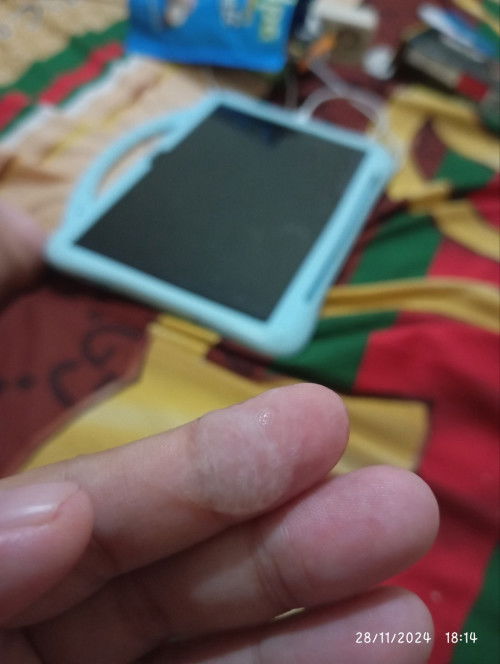 Keluar lendir seperti ingus/jelly