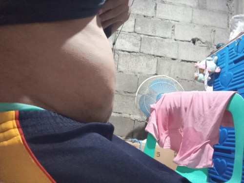 Normal Po ba Ang laki ng toyan ok after ma cs? Mag 3 months n po