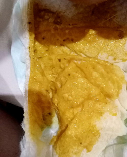 Anak bayi 4bln bab 4x dalam sehari