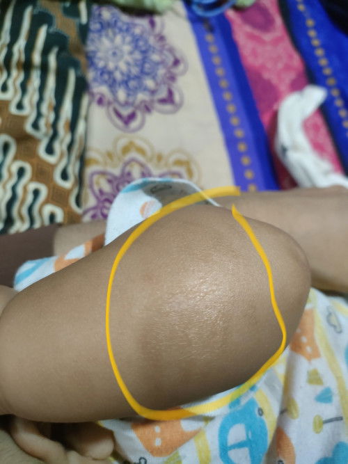 Tangan bayi 4 bulan kering