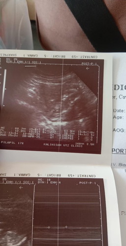 16 WEEKS PREGNANT