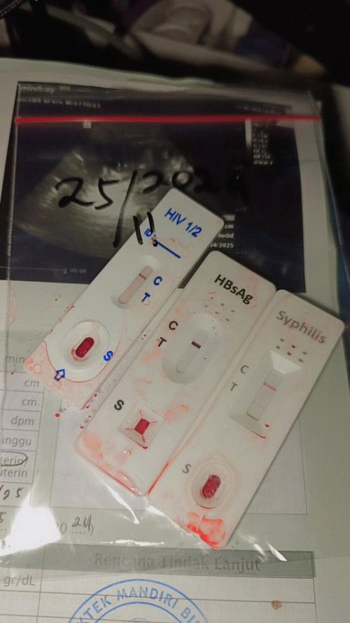 Udah pernah Cek lab belum mom