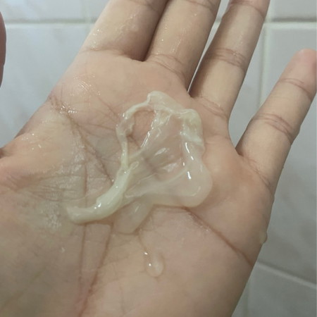 แบบนี้ปกติไหมคะ