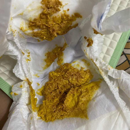 normal ke najis baby warna mcm ni?