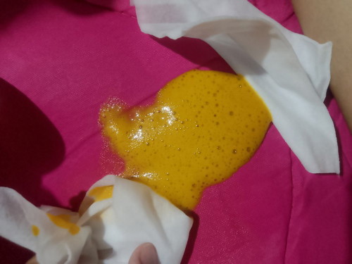 Ano po dahila kung bat naging parang Bula dumi ni baby