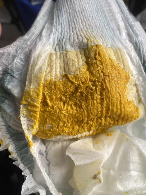 Các mẹ cho e hỏi với ạ.