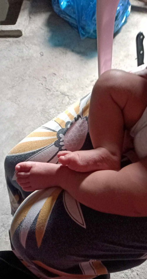 Best ointment na mai-recommend sa may rashes 3months old baby.