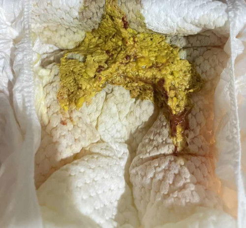 Keadaan Najis si manja selepas sebulan.