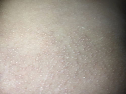 Dikasihin apa ya bun