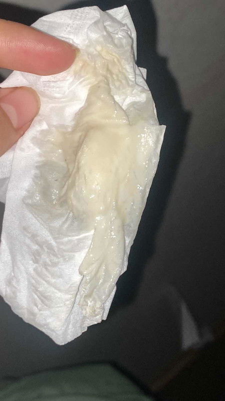 ตกขาวเยอะมาก