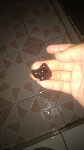 Hamil d semester 1 ko ngeflex coklat yah sampai keluar Kya gumpalan ati ayam tpi prut gx sakit