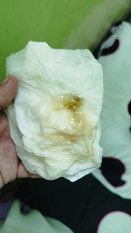 38 W 5 Hari, malam nya mules. Pagi keluar lendir coklat.