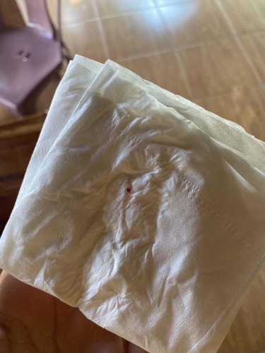 ท้องแรก อายุครรภ์36+3