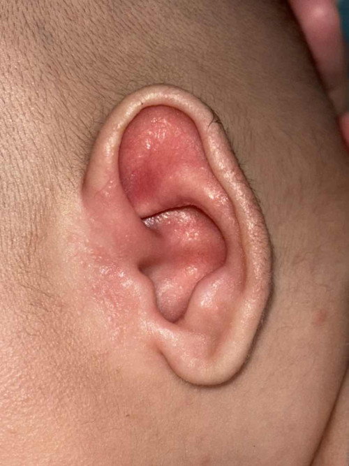 Telinga bayi