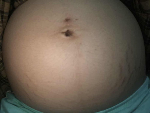 แม่ๆช่วยแนะนำหน่อยค่ะ