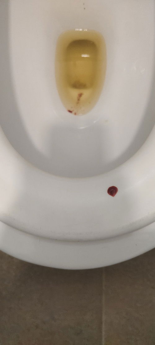 Bleeding or spotting?