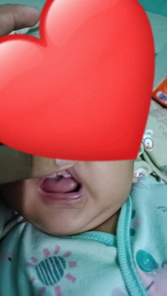 gusi bayi 1 bulan