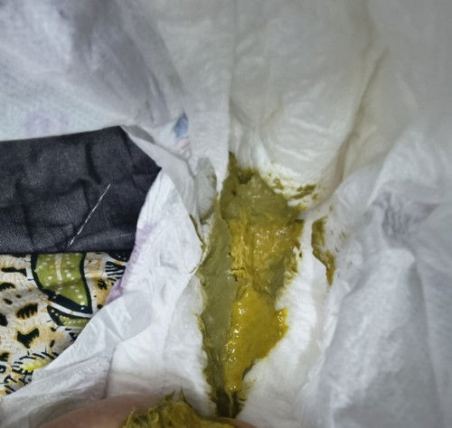 Normal ke najis bayi warna mcm ni...