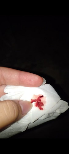 Sempet telat 2 hari